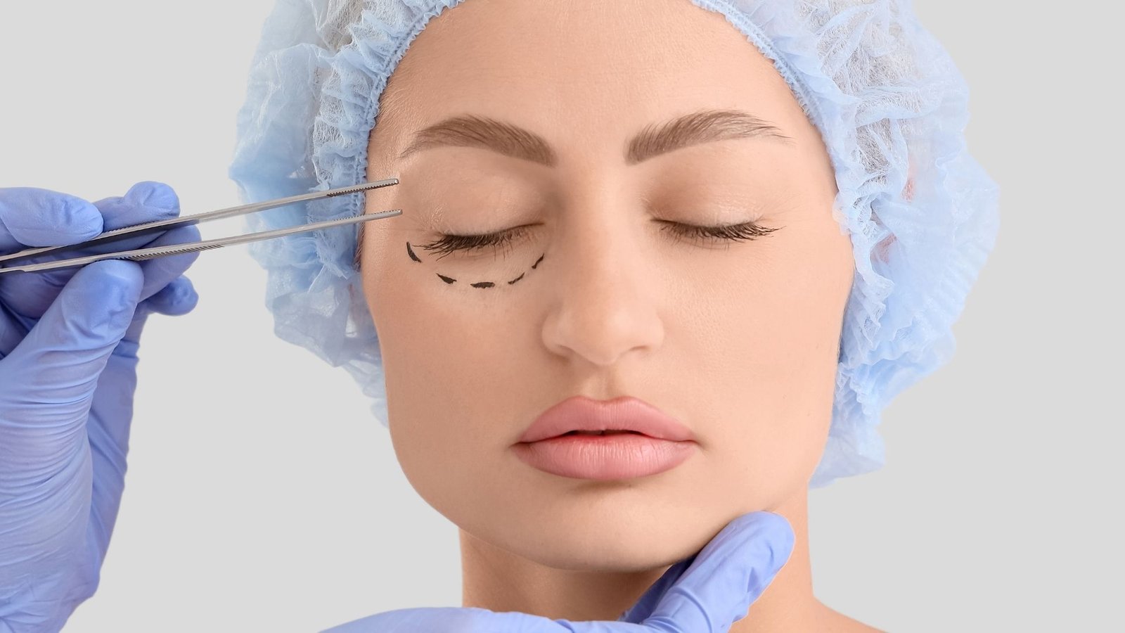 Eyelid surgery at Dr. Havva Duru İpek Kliniği, Istanbul